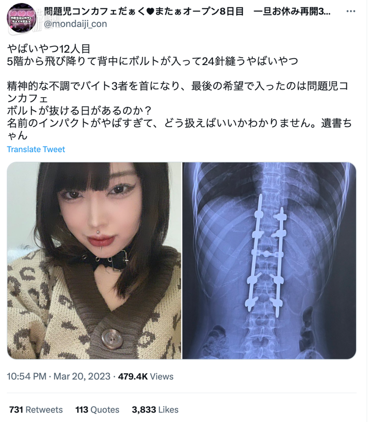 “从五层一跃而下，背部缝了24针”