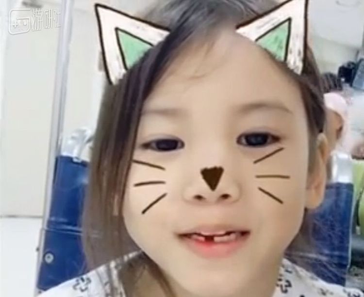 正在换牙的Nayeon